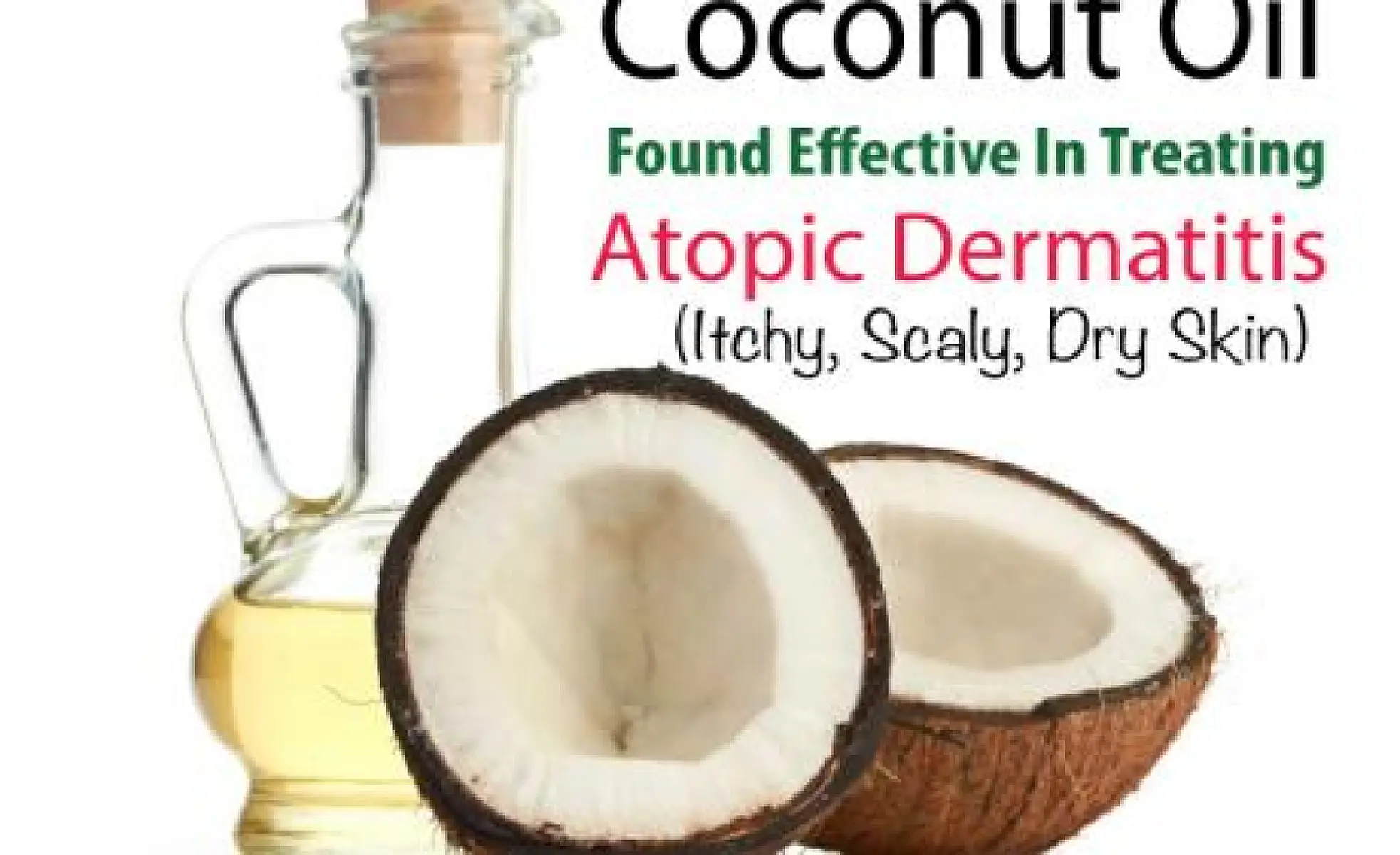 Coconut Oil Found Effective In Treating Atopic Dermatitis (Dry, Itchy, Scaly Skin)