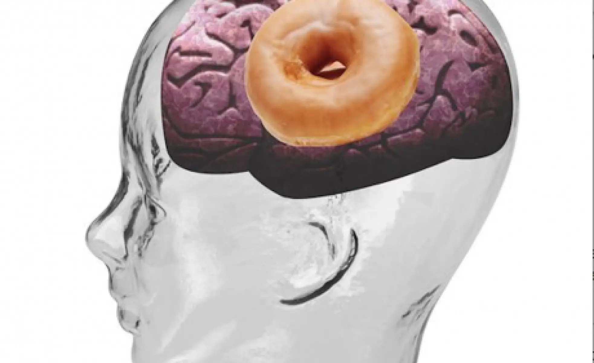 Sugar and Your Brain: Is Alzheimer's Disease Actually Type 3 Diabetes?