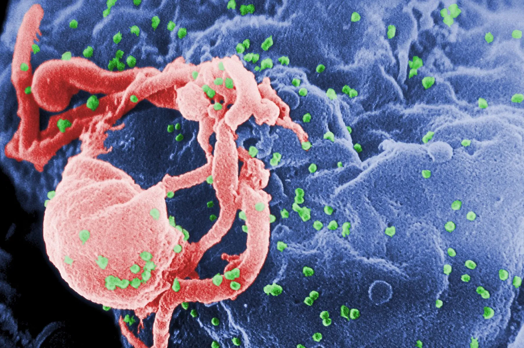 The Importance of Integrative Medicine in the Treatment of HIV/AIDS