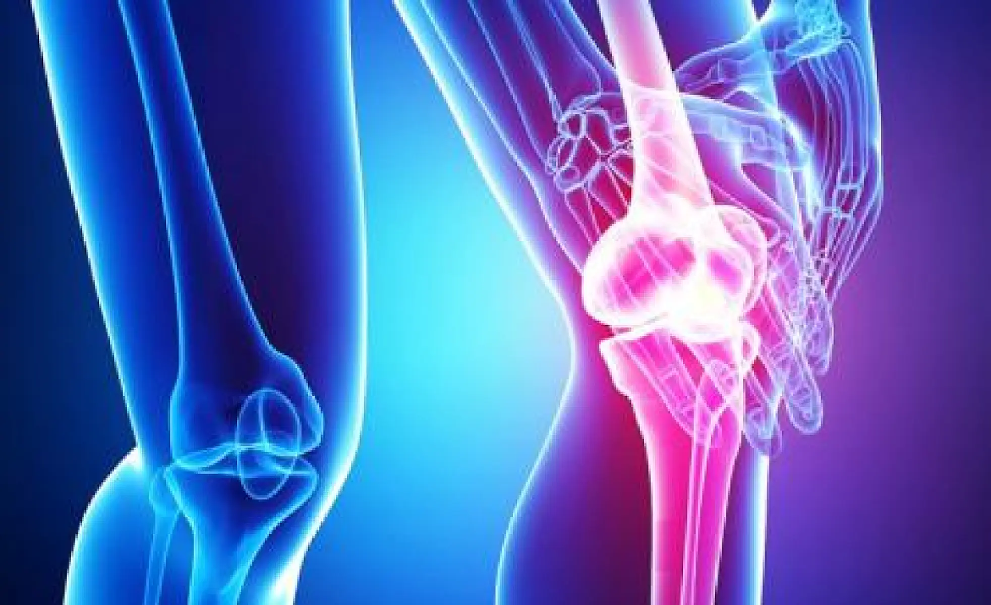 A New Way to Treat Arthritis