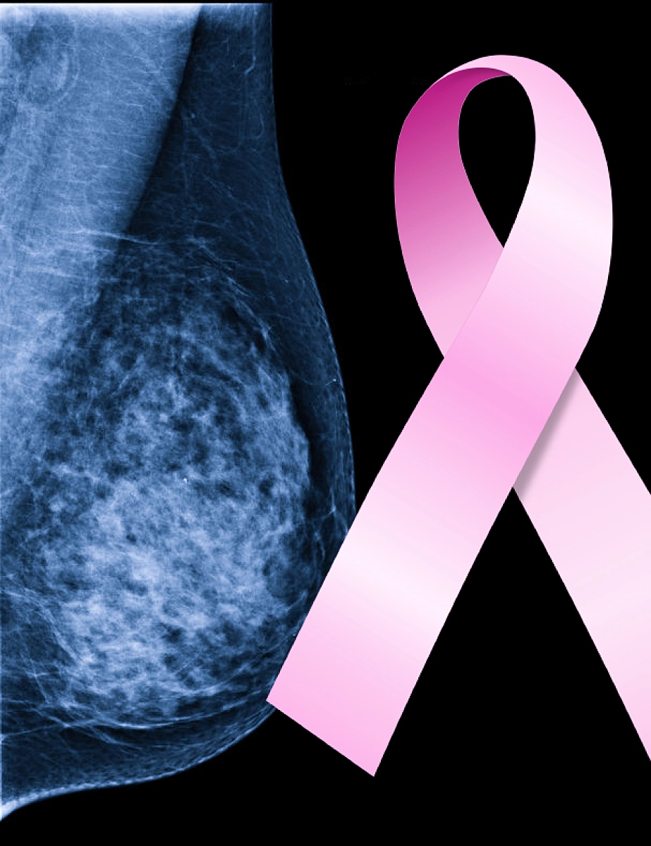 The Critique Of The Latest Anti-Mammogram Study: Scientific Or Political?