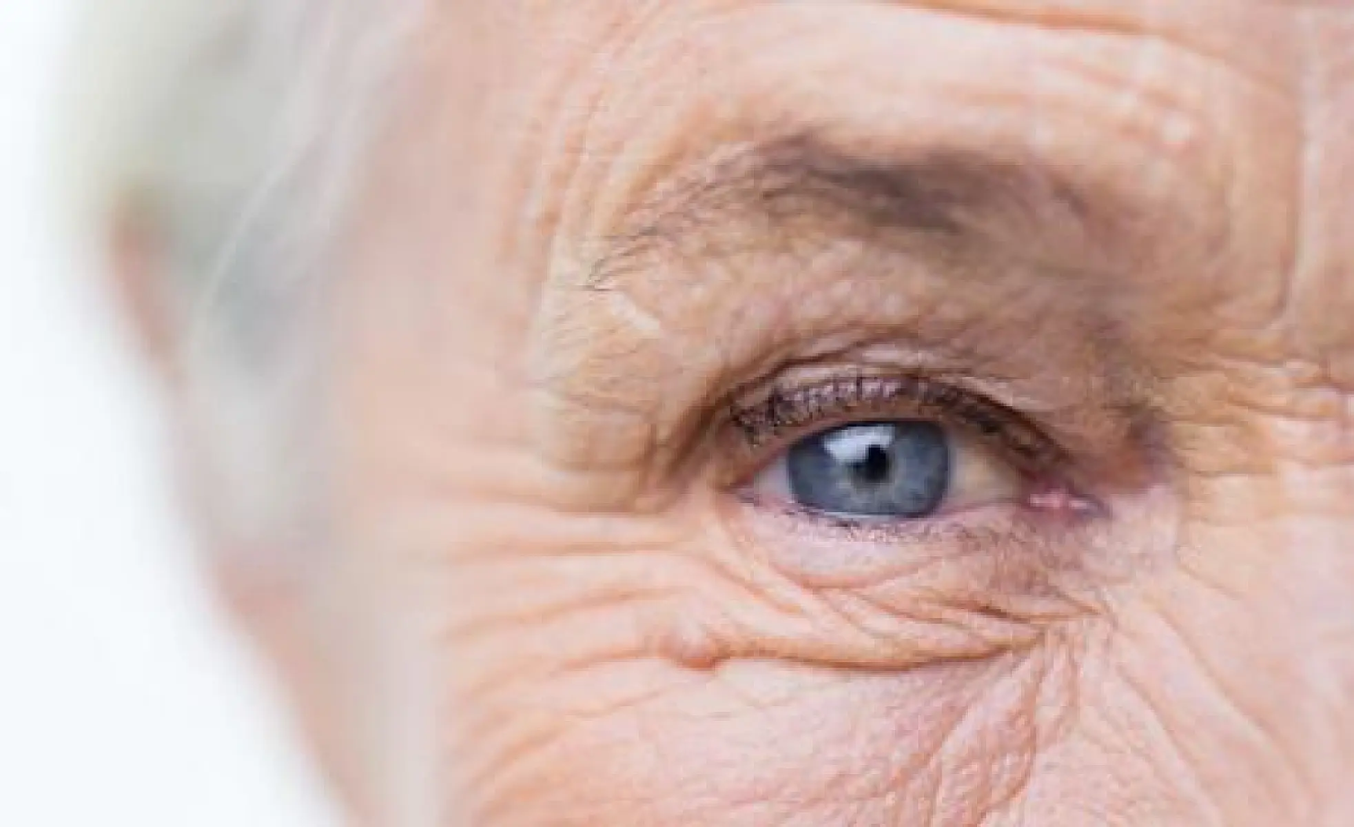 5 Proven Ways to Reduce Wrinkles Naturally