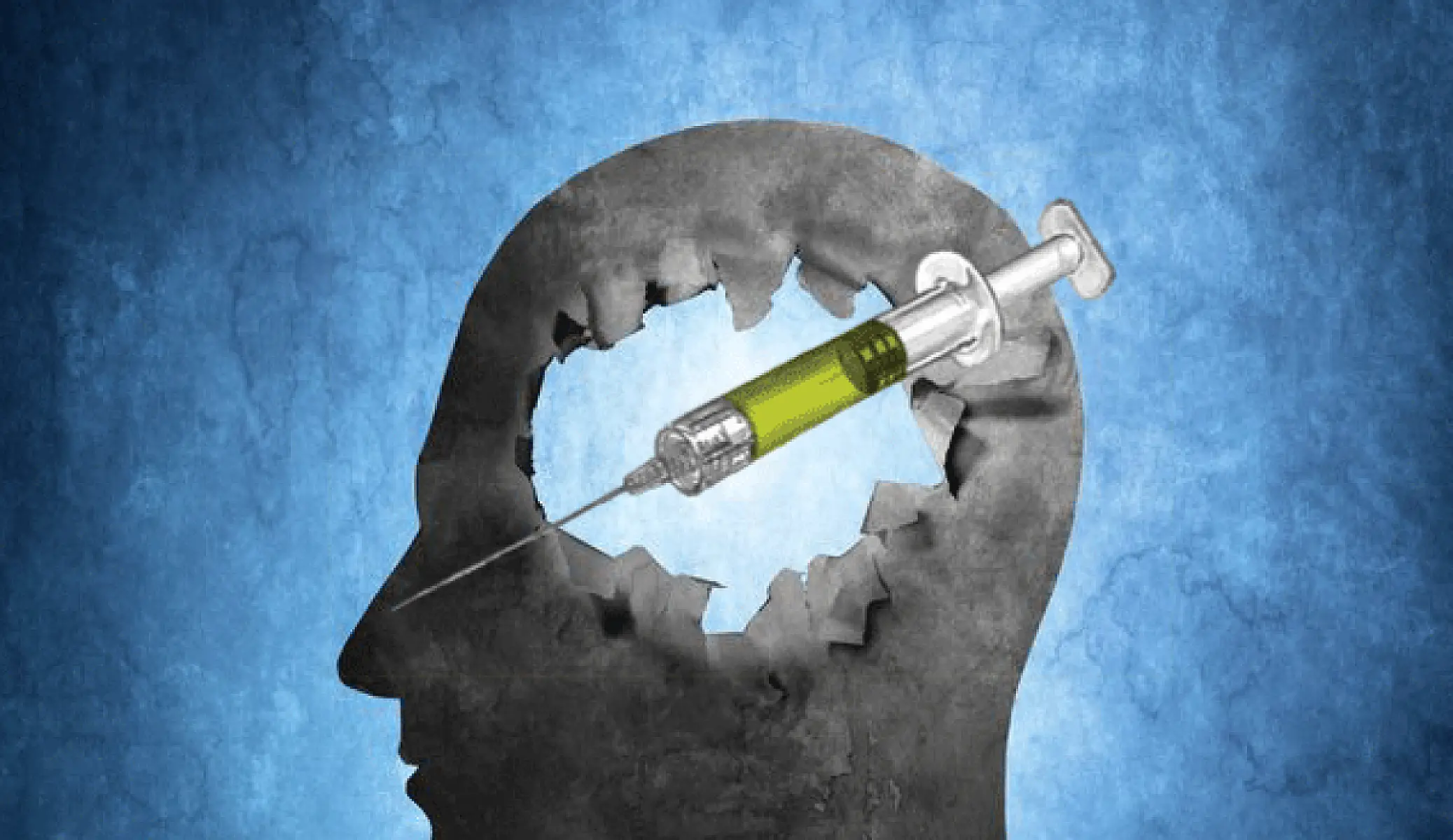 H1N1 Flu Vaccine: 14-Fold Increased Risk For Incurable Brain Condition