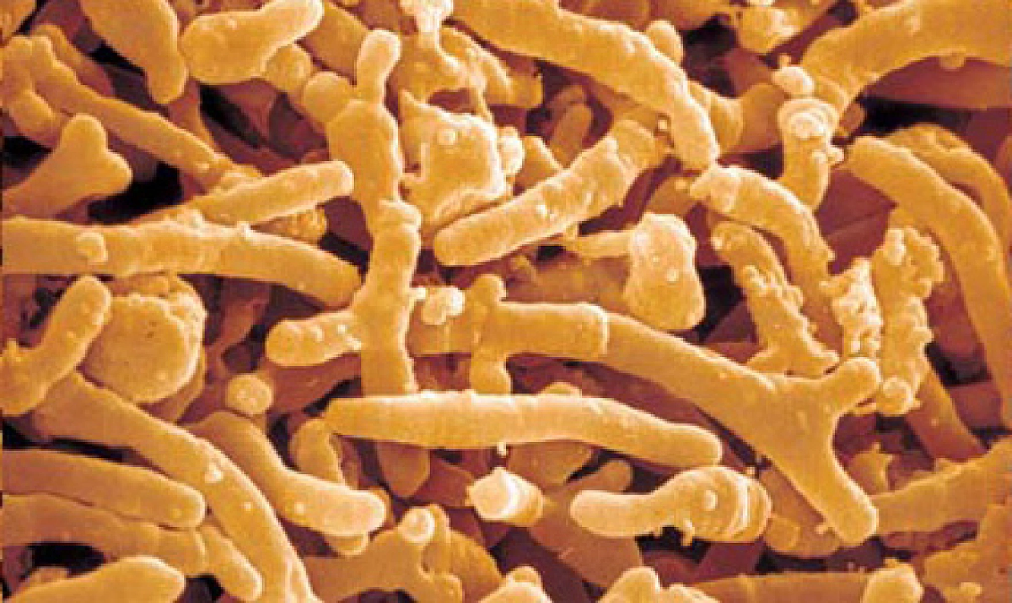 Vaccine Injury: The Biological Plausibility of Microbial Predisposition