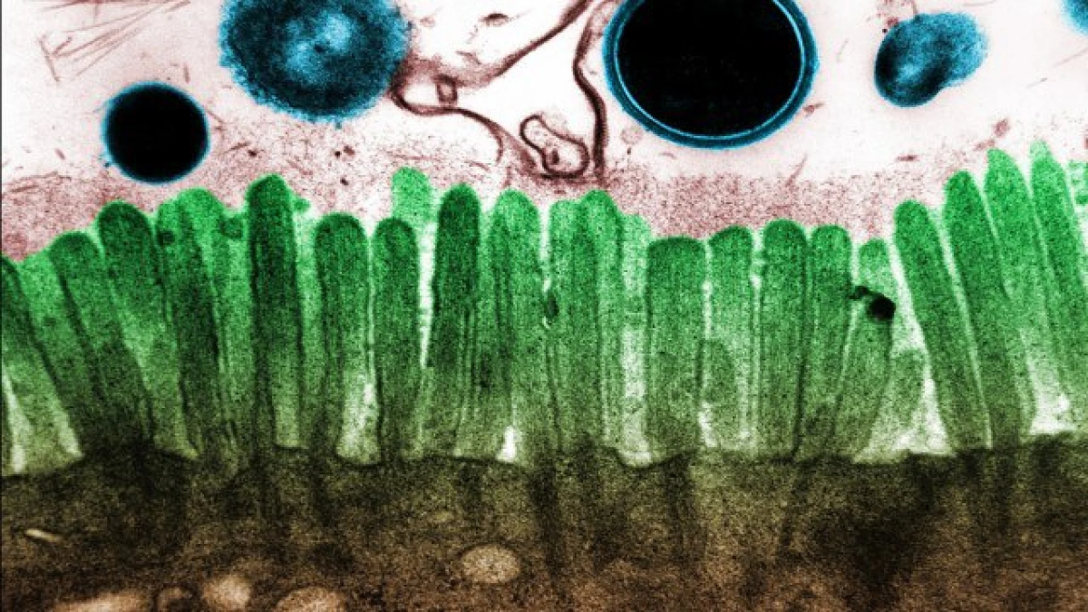 The Critical Role of Microflora In Vaccine Injury