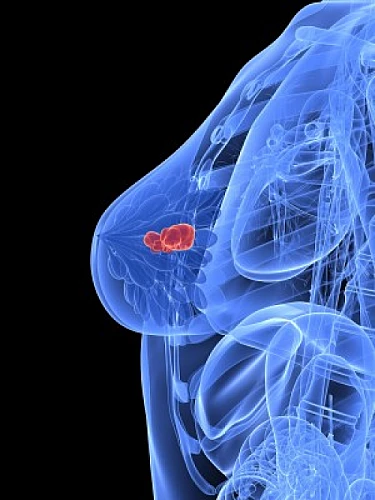 Metalloestrogens: A New Class Of Cancer Causing Estrogens