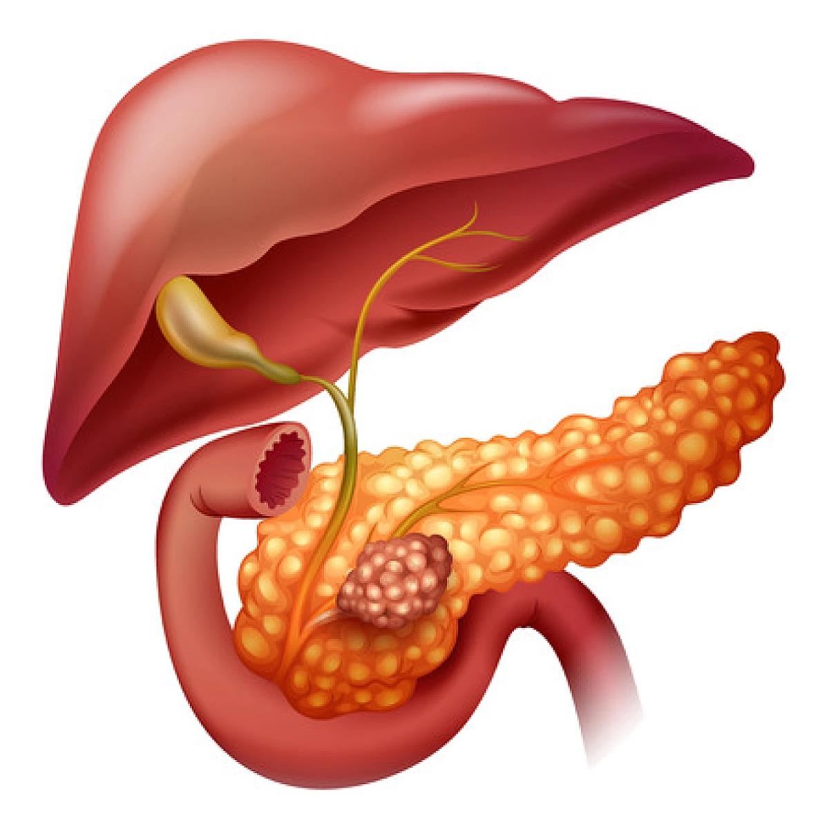 Phase I Detoxification Enzyme Inducer