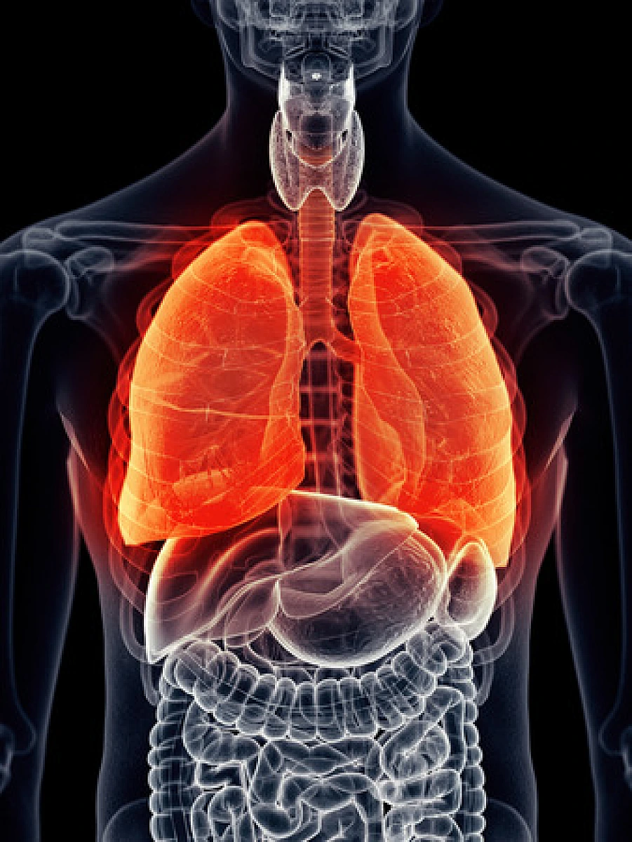 Cyanide Poisoning