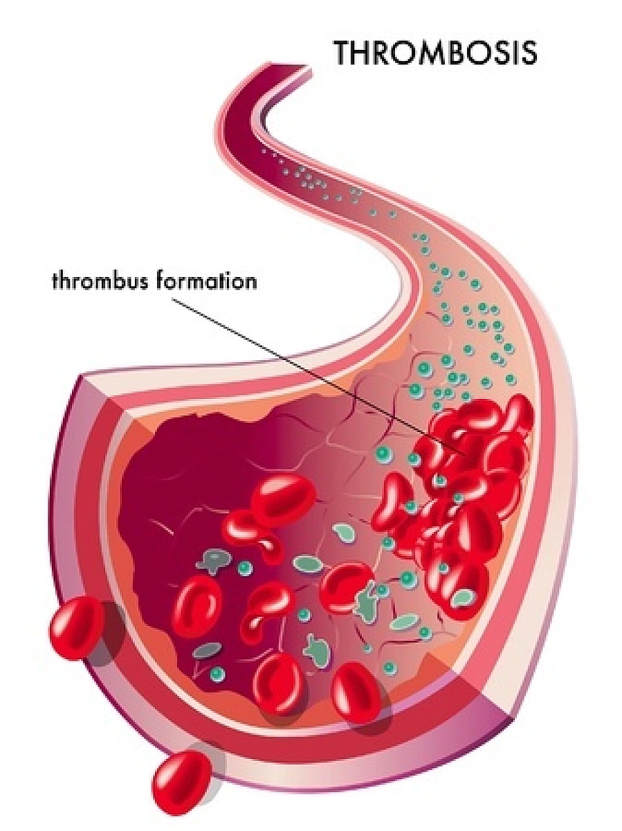 Sodium Dichromate