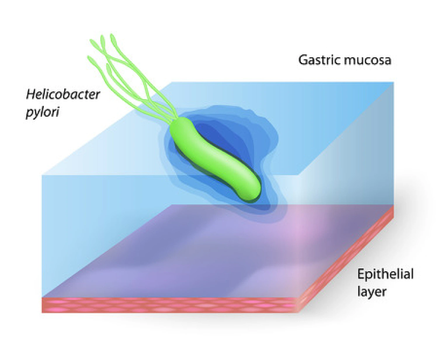 Myotoxicity