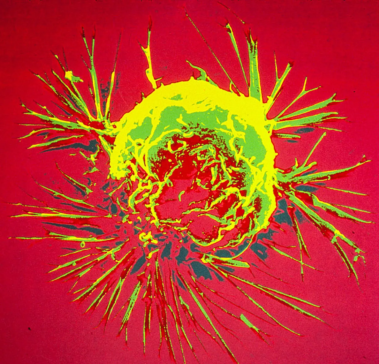 BRCA: The Lore of the Breast Cancer Gene
