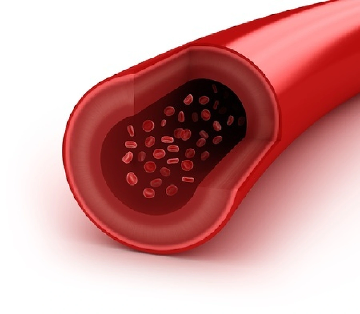 Neocardiogenic