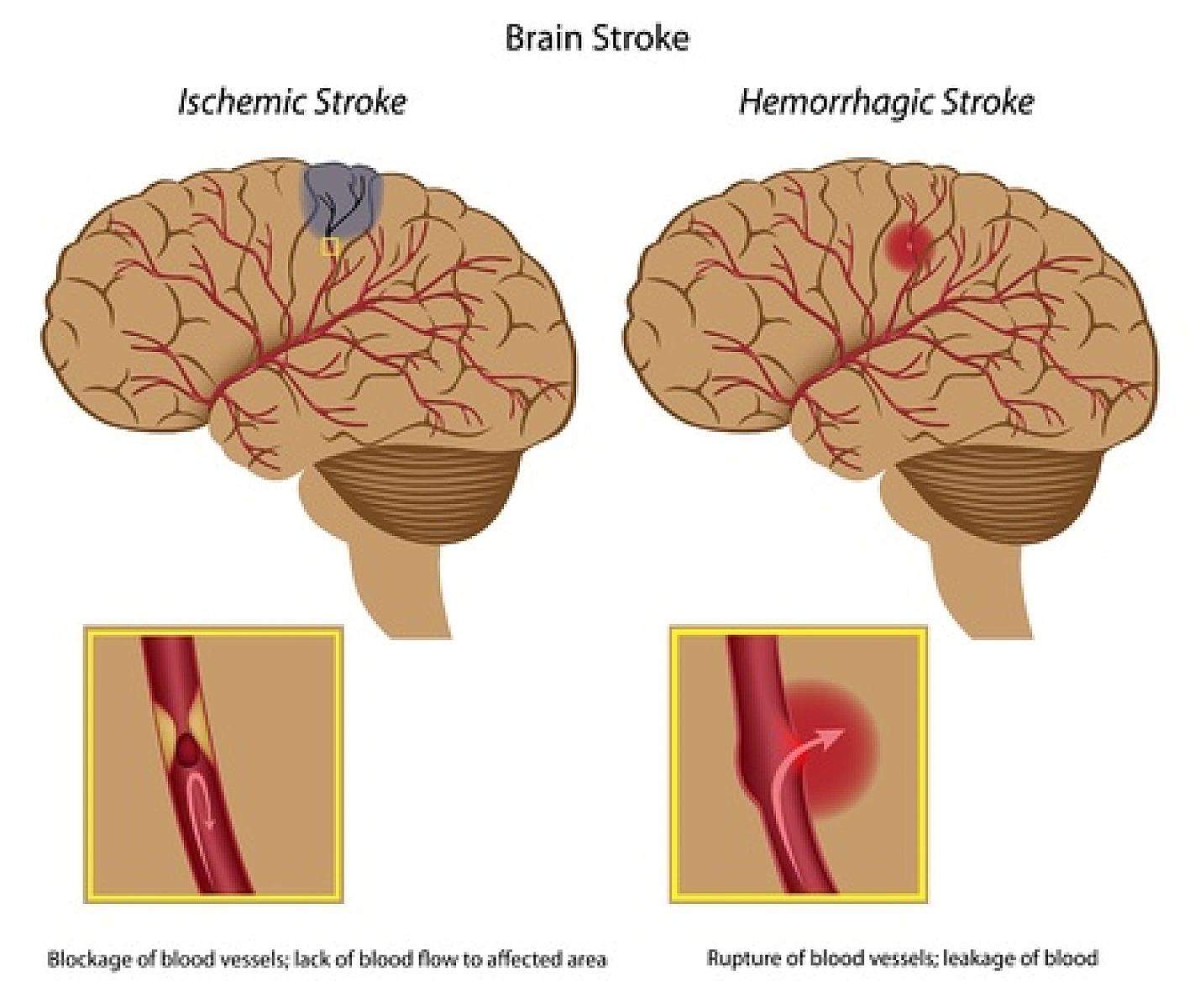 SCENAR Therapy (electronic biofeedback)