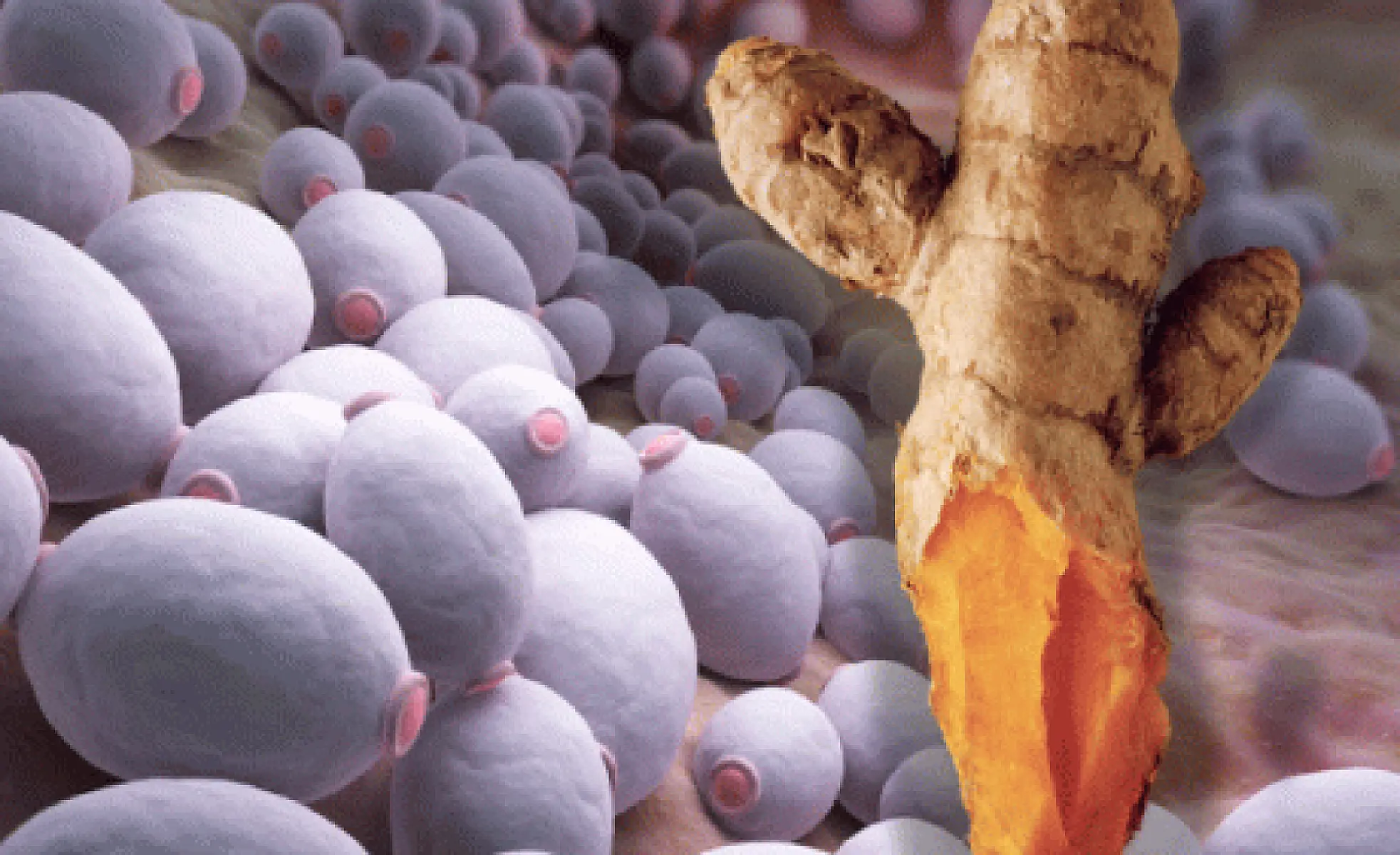 Yeast is a Cause of Cancer and Turmeric Can Kill Both, Research Confirms