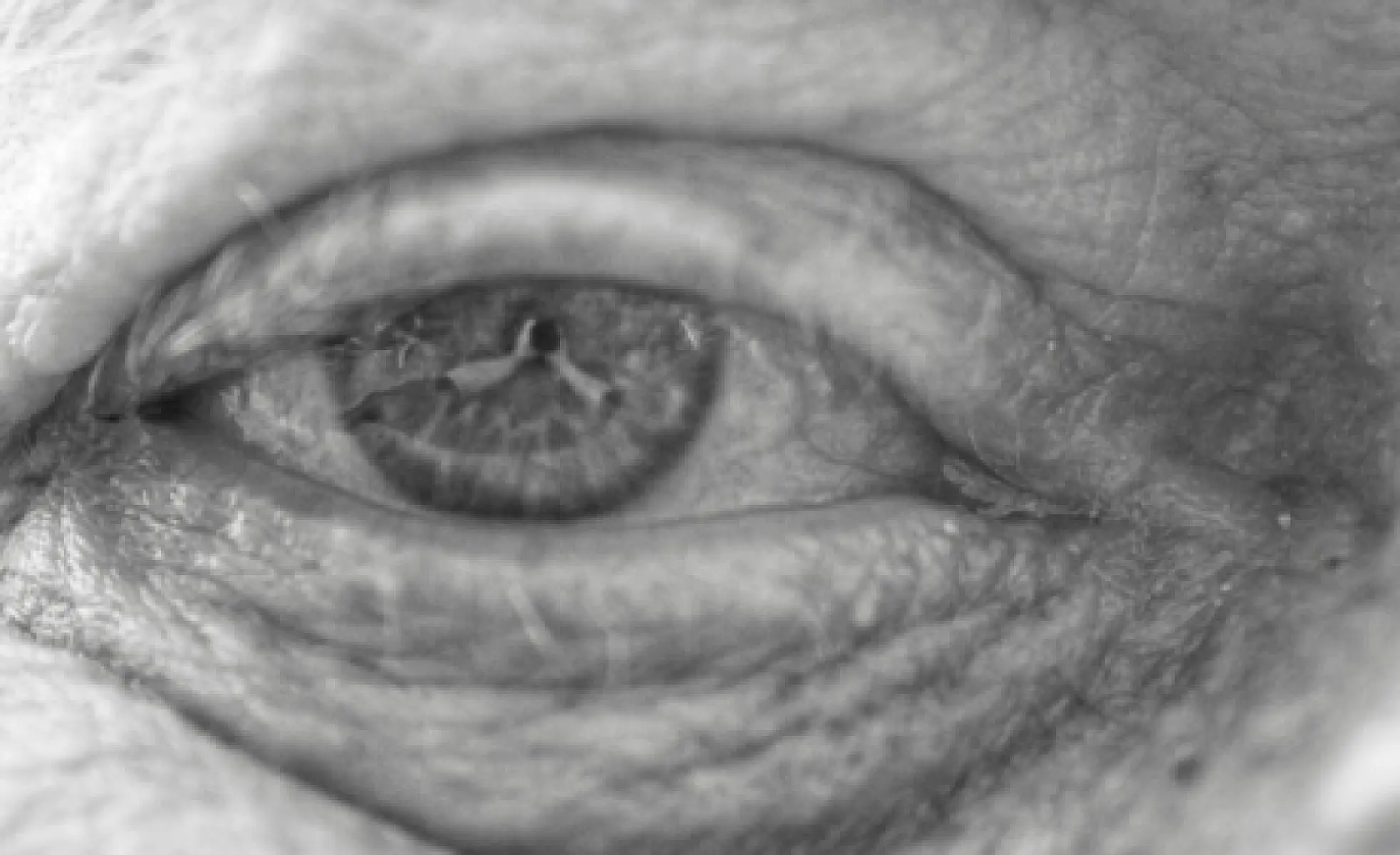 7 Foods and Nutrients Proven to Cut Macular Degeneration Risk