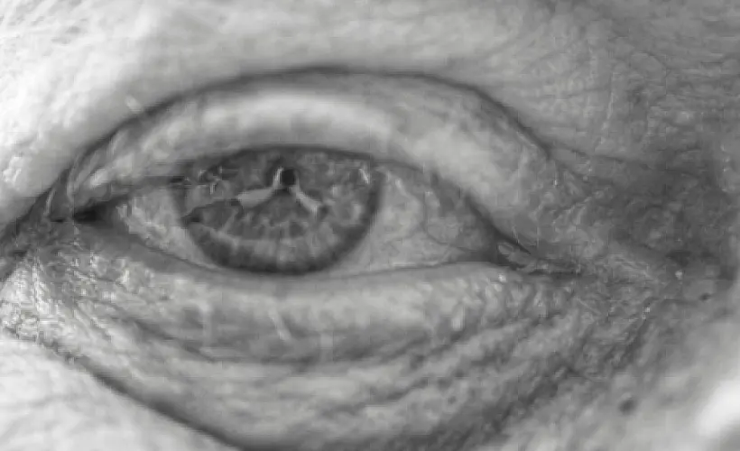 7 Foods and Nutrients Proven to Cut Macular Degeneration Risk