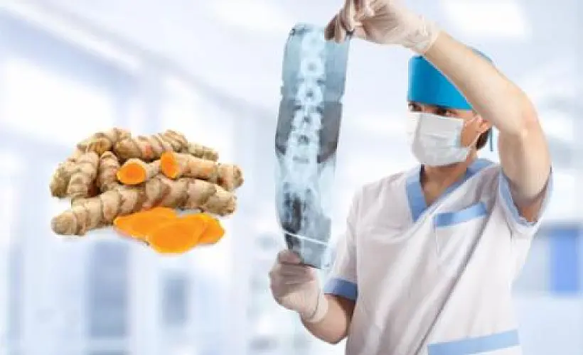 Turmeric Heals Spinal Cord Injuries Better Than Drugs/Surgery, Review Suggests