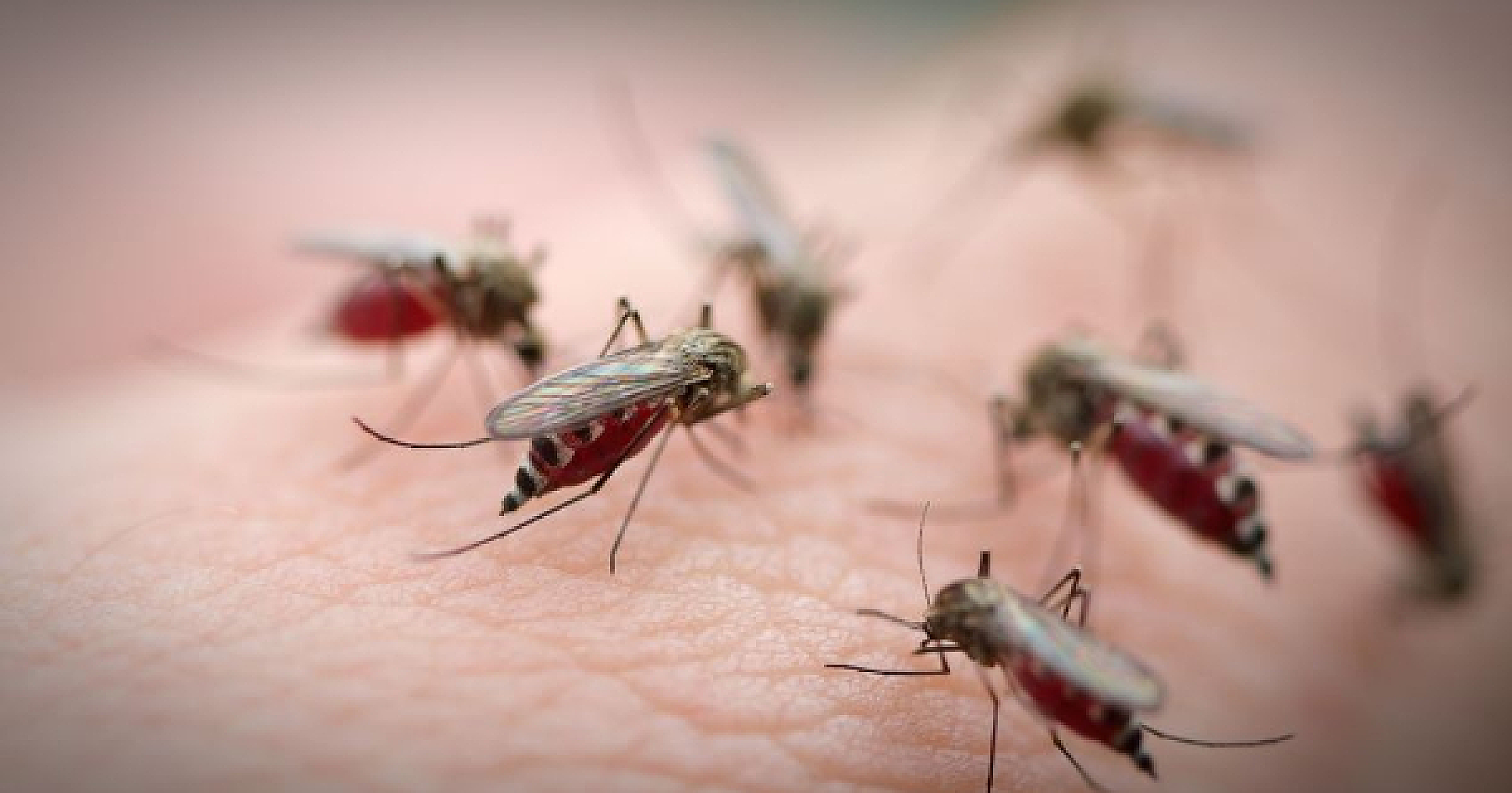 The Lethal Suspects for Microcephaly in Brazil, With Zika Virus at the Bottom of the List