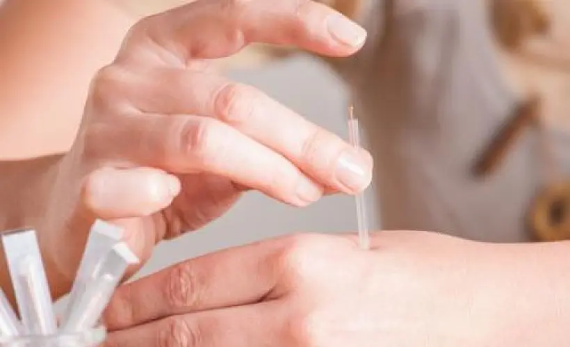 Acupuncture Beats Injected Morphine for Pain: Groundbreaking Study
