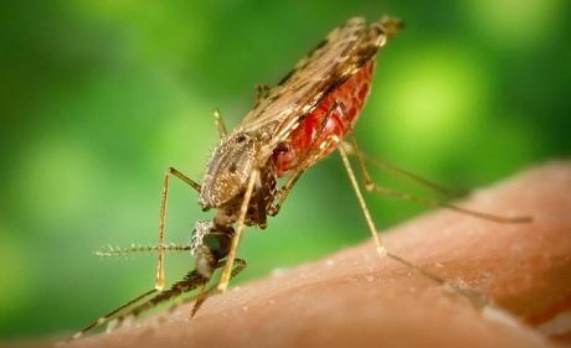 Zika Virus or Roundup Herbicide The Cause of Microcephaly?