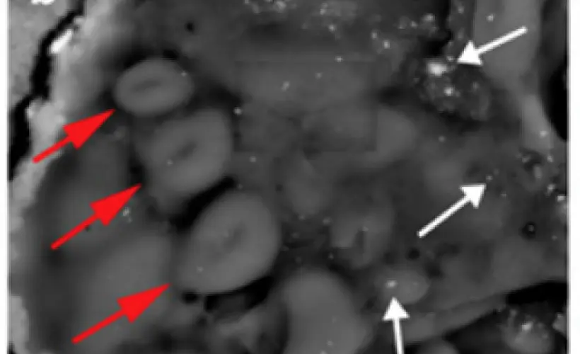 Dirty Vaccines: Every Human Vaccine Tested Was Contaminated With Metals and Debris in New Study 