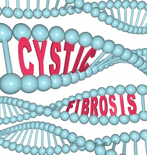 43 Natural Alternatives for Cystic Fibrosis