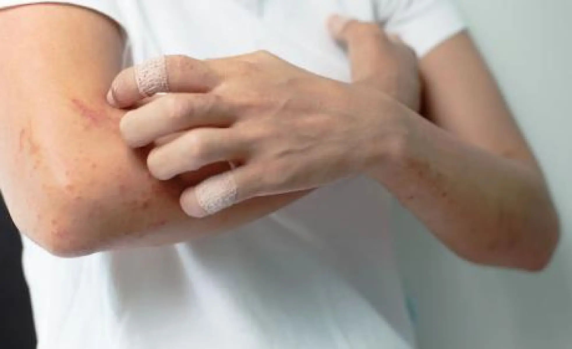 Shingles Vaccine Dangers Exposed In FDA Letter to Merck