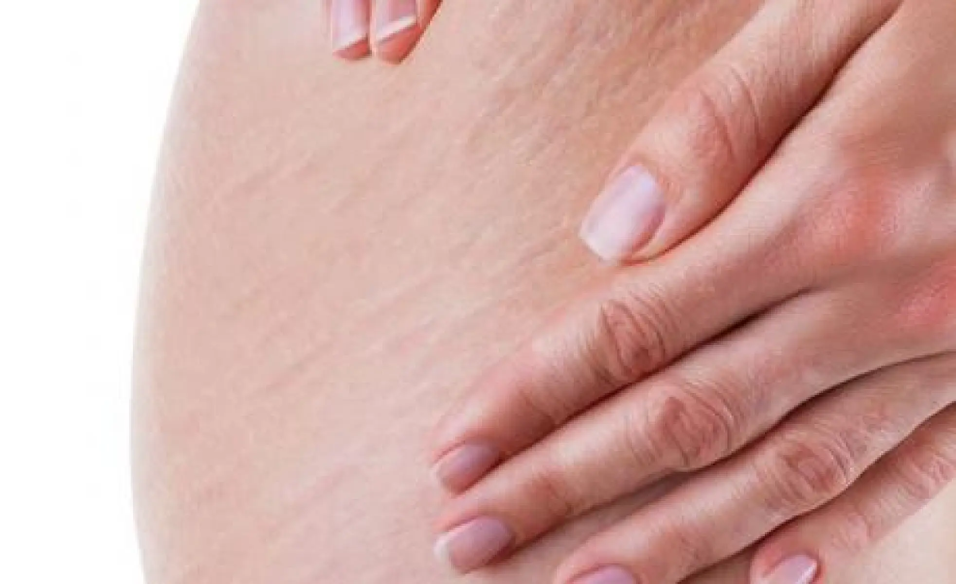 3 Evidence-Based Ways to Reduce Cellulite