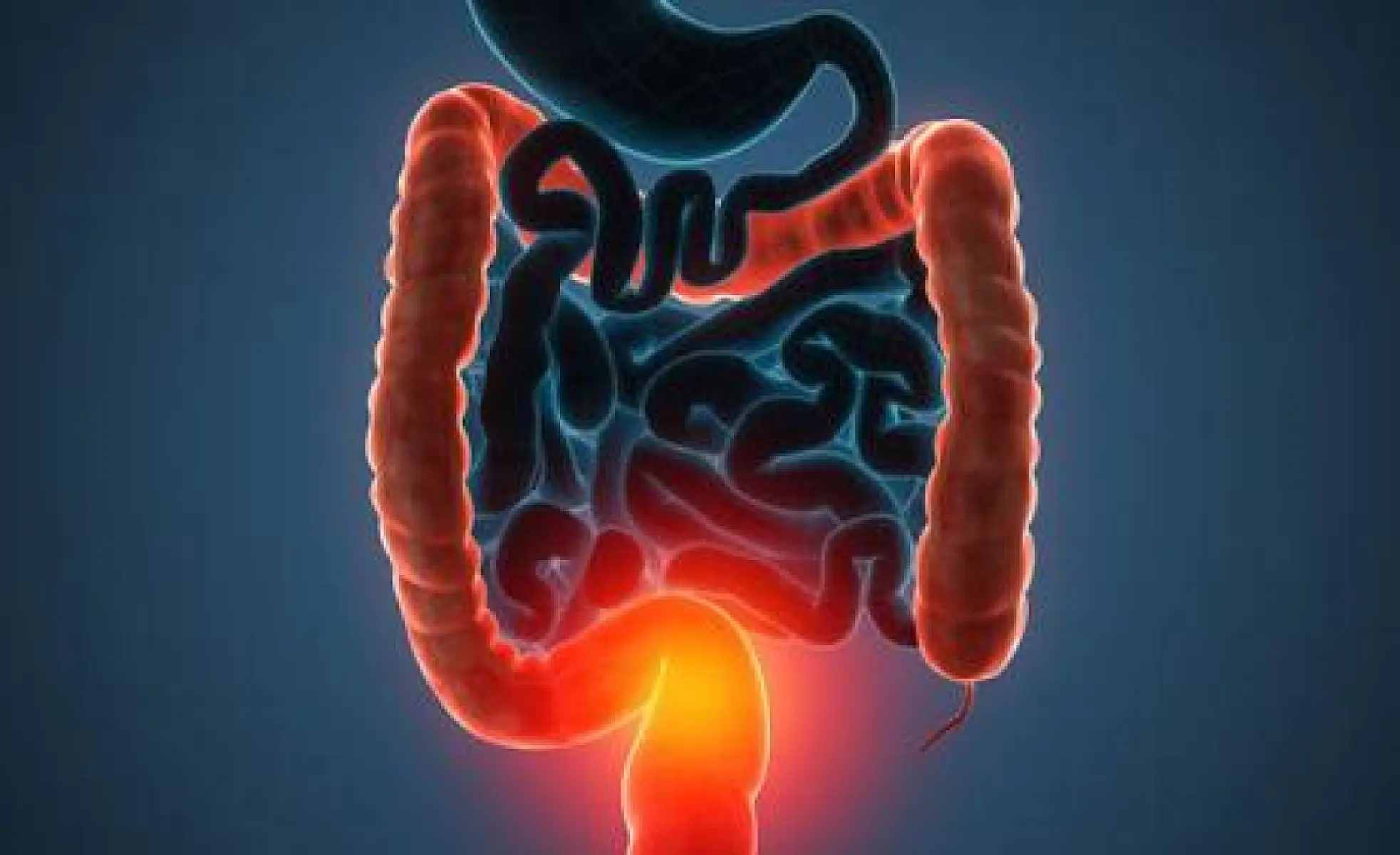 Fecal Transplants for Allergies, Autism, and Autoimmune Disease