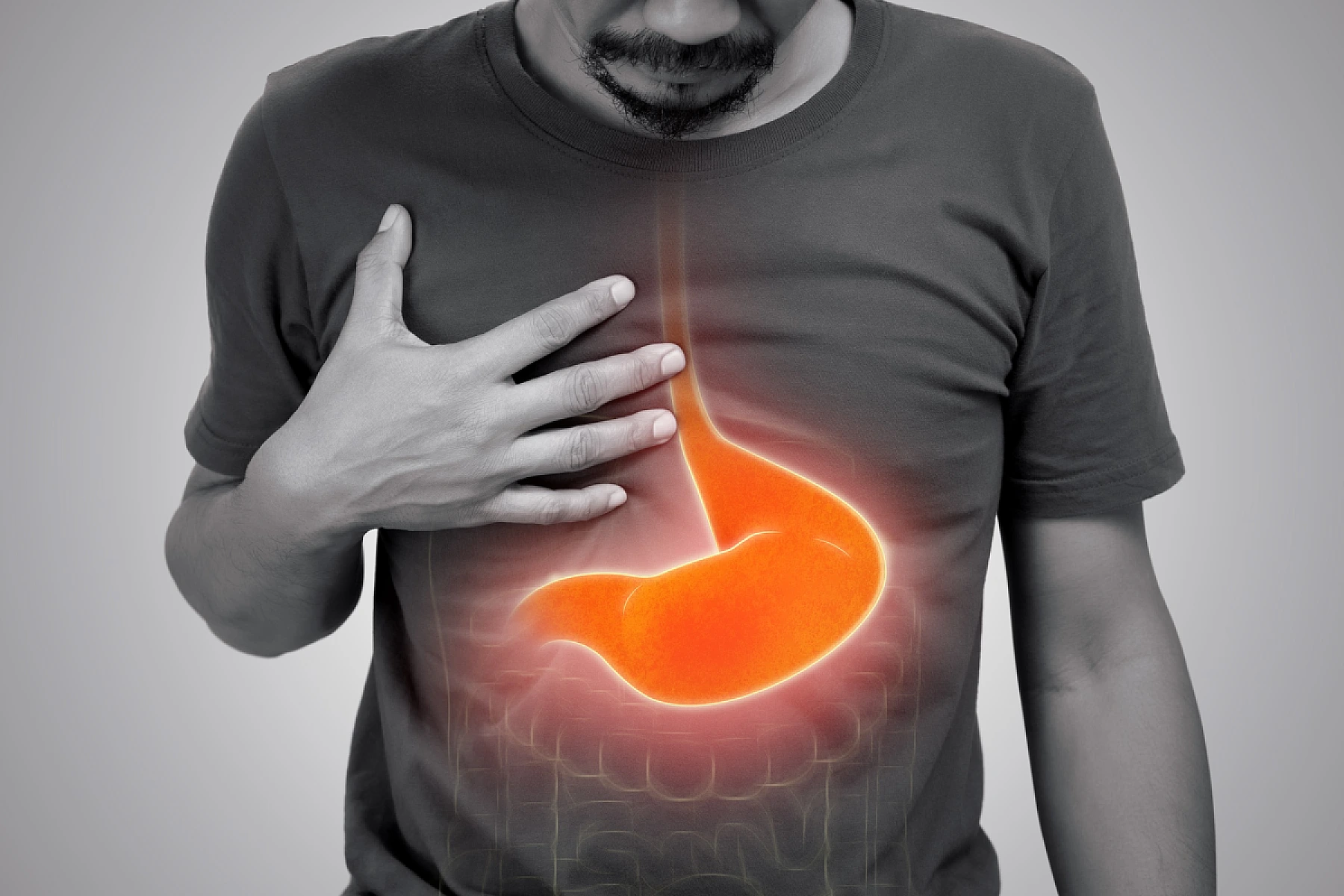Top 5 Reasons NEVER to Take an 'Acid Blocker'