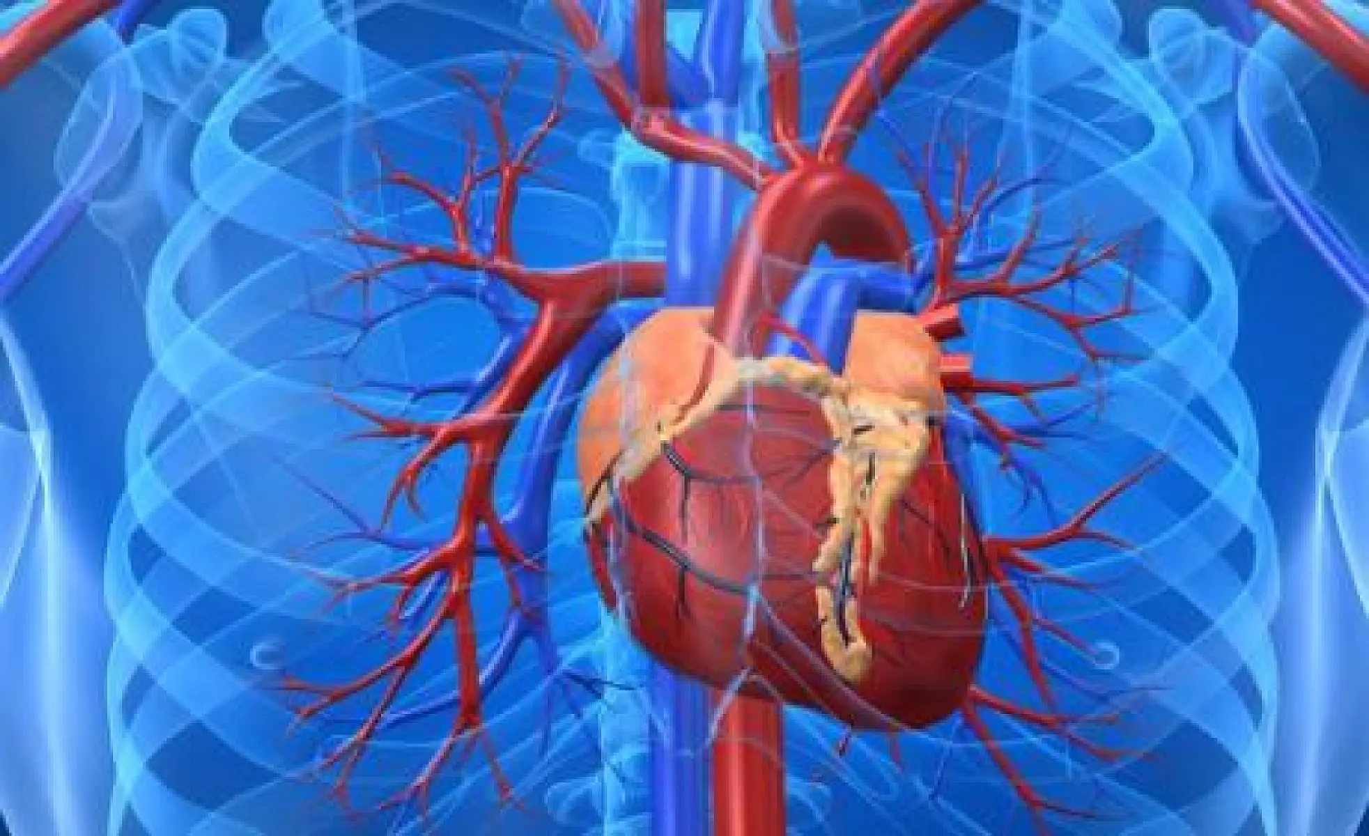 Cholesterol Levels and Atherosclerosis: Autopsy Studies Show No Correlation