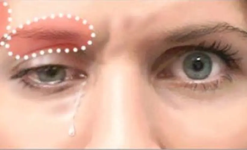 Botox’s Ugly ‘Side Effects’ Run Deeper Than Skin, Alter Mind & Numb Emotion