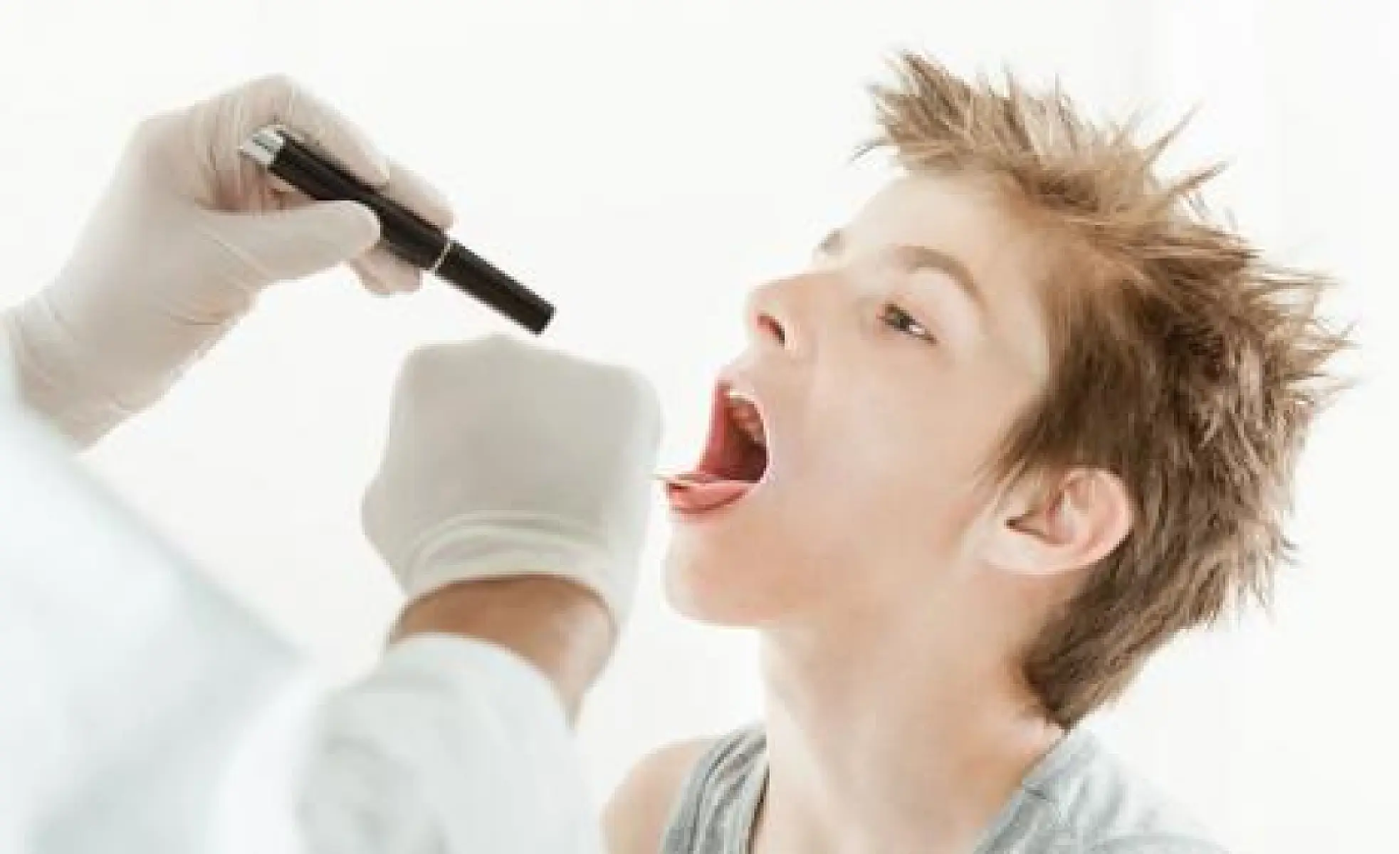 Removing Children's Tonsils and Adenoids Increases Risk for 28 Diseases, Study Finds