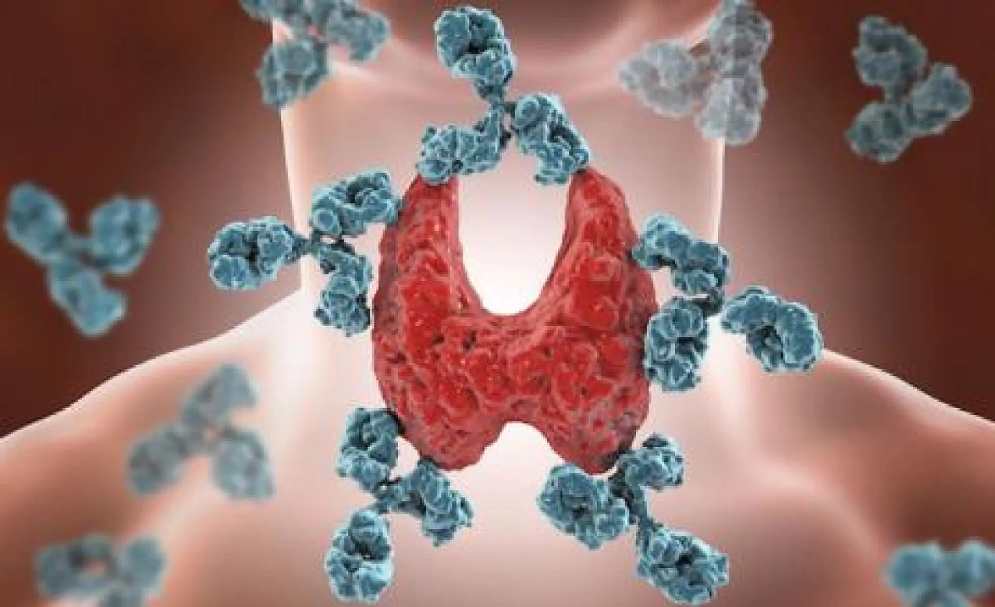 What is Hashimoto’s Disease and Why Does Synthetic T4 Fail To Improve Well-Being?