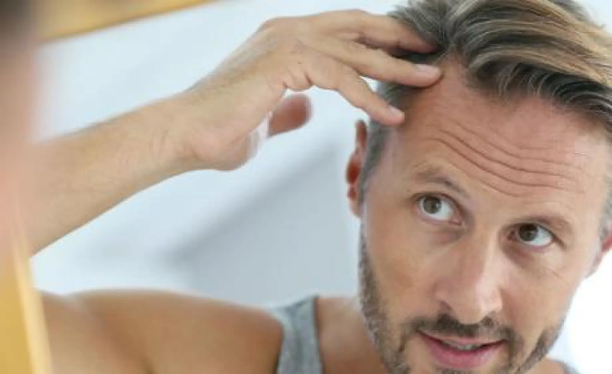 6 Ways to Reverse Hair Loss