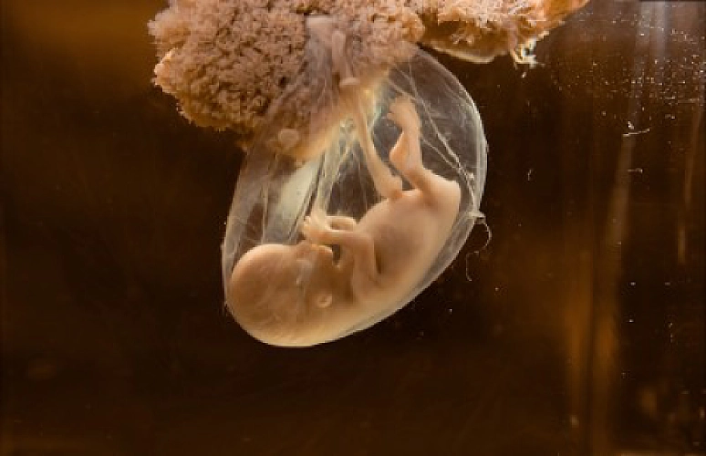 Breaking Water Balloons and Amniotic Sacs