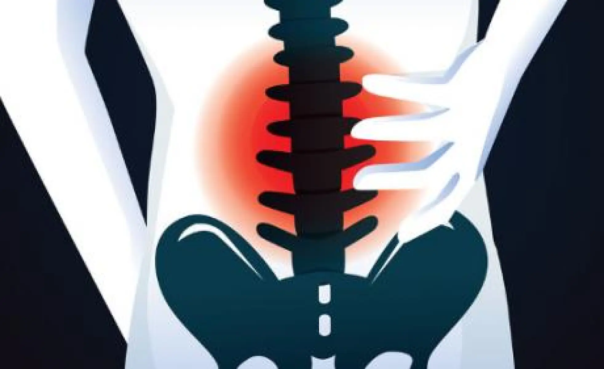 Self-Administered Acupressure Can Ease Lower Back Pain