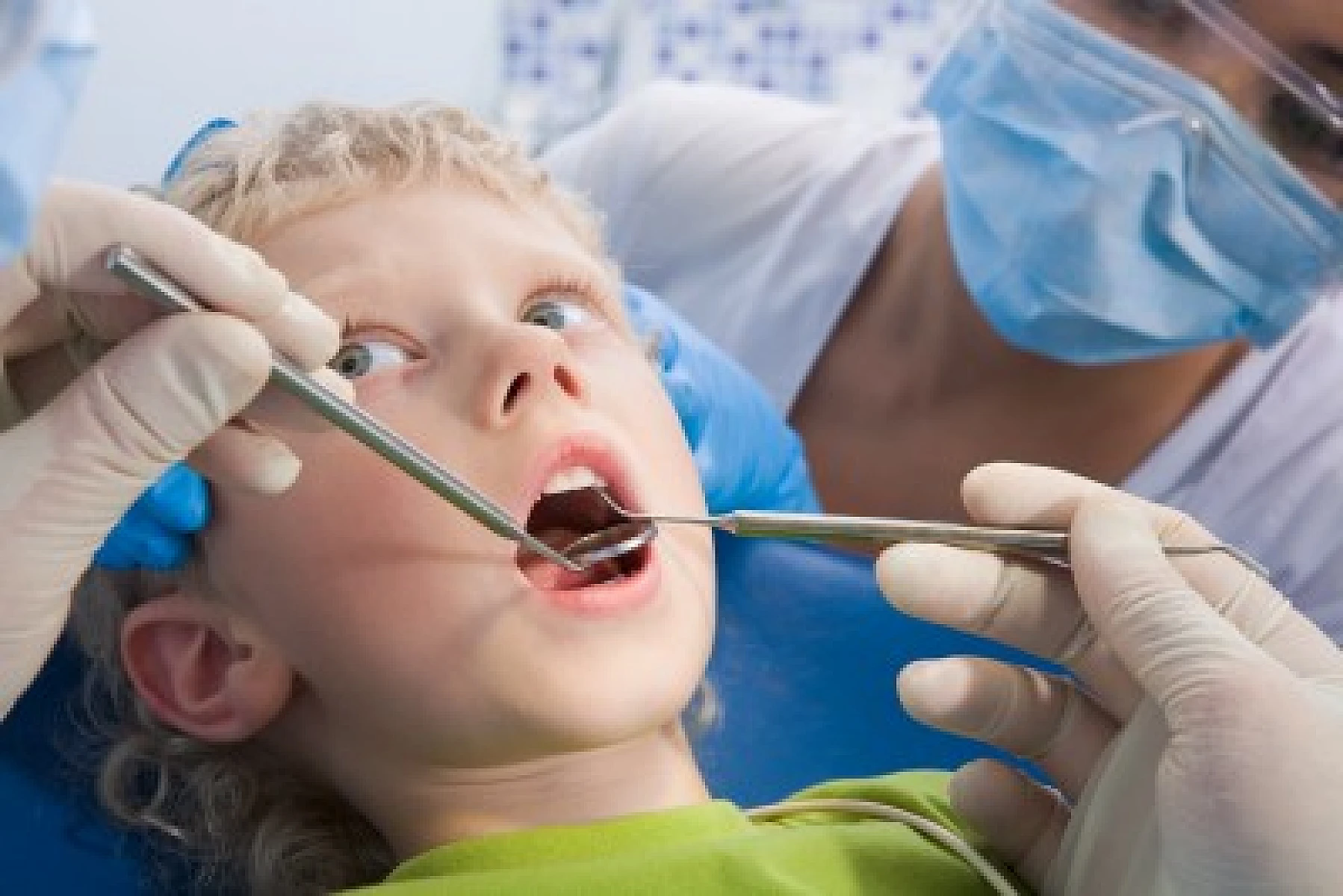 Dental Composites for Kids: Even Worse Than Mercury Amalgam?