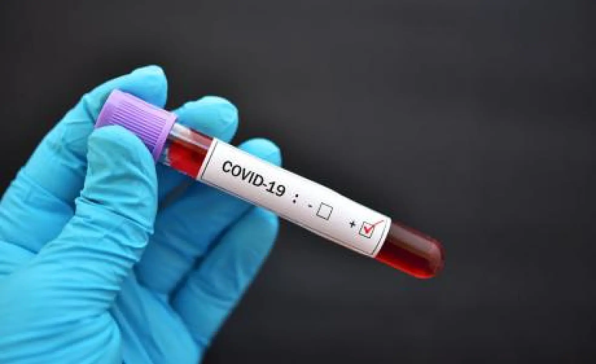Stanford Team Finds Evidence COVID-19 Mortality Rate Is As Low as .2% (17 Times Lower Than WHO's Estimate)