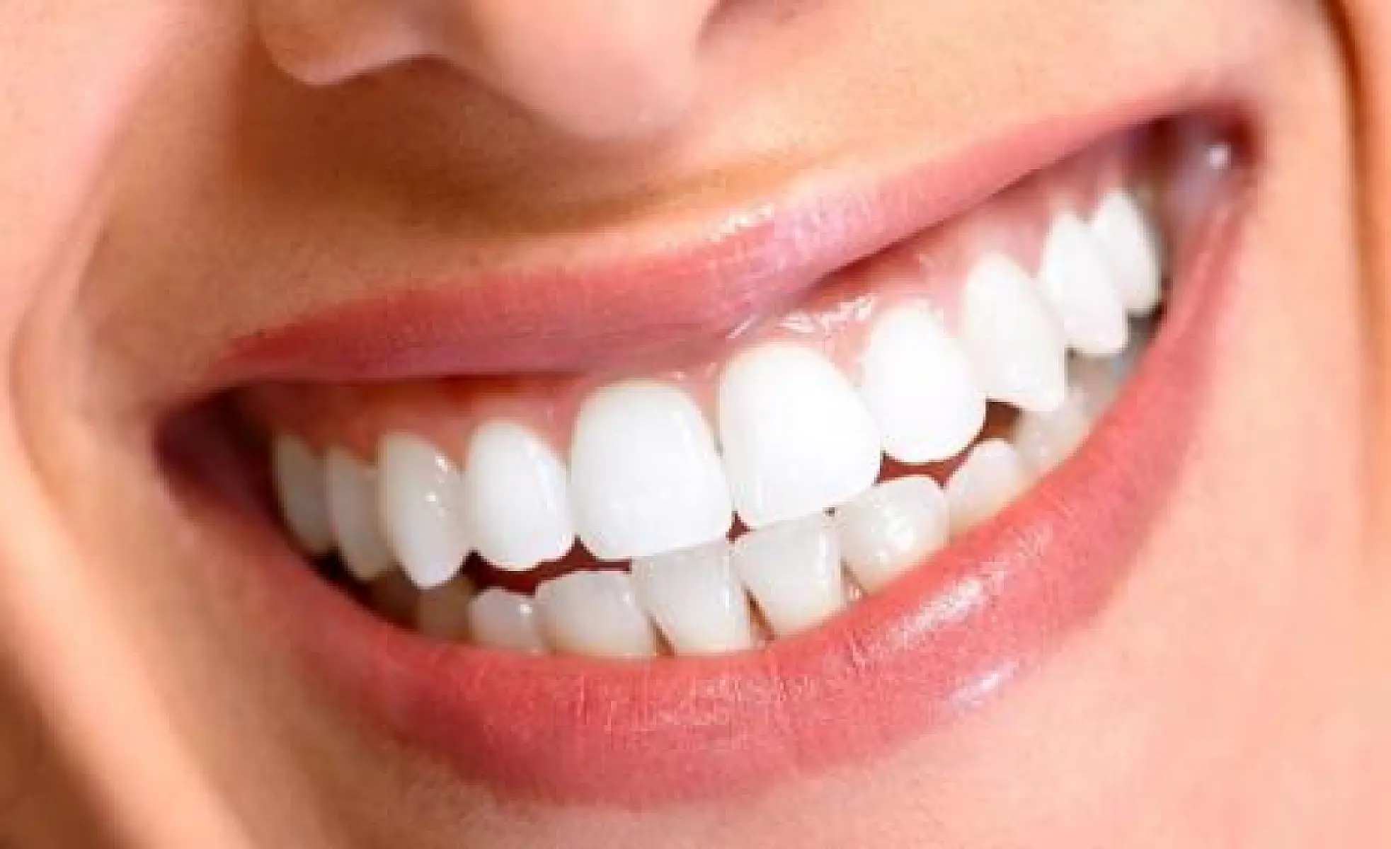 Six Natural Substances to Alleviate Periodontal Disease