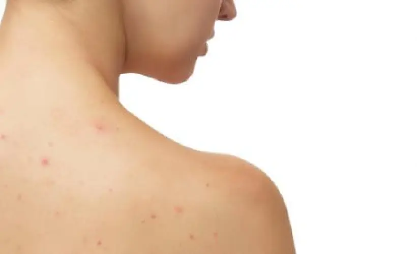 Natural Remedies for Taking Care of Your Skin