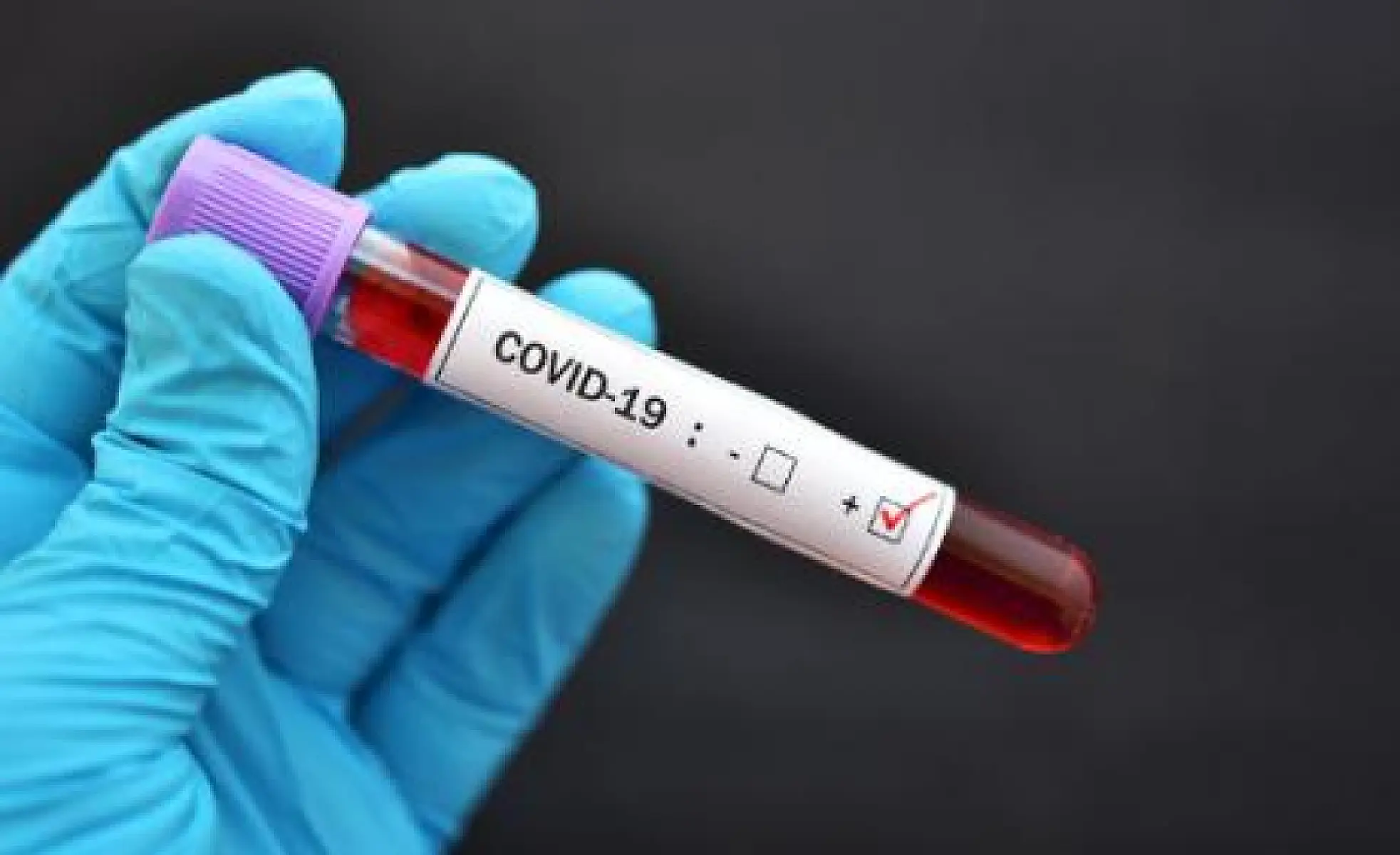 CDC Comes Clean: New Fatality Rate is a Shocker!
