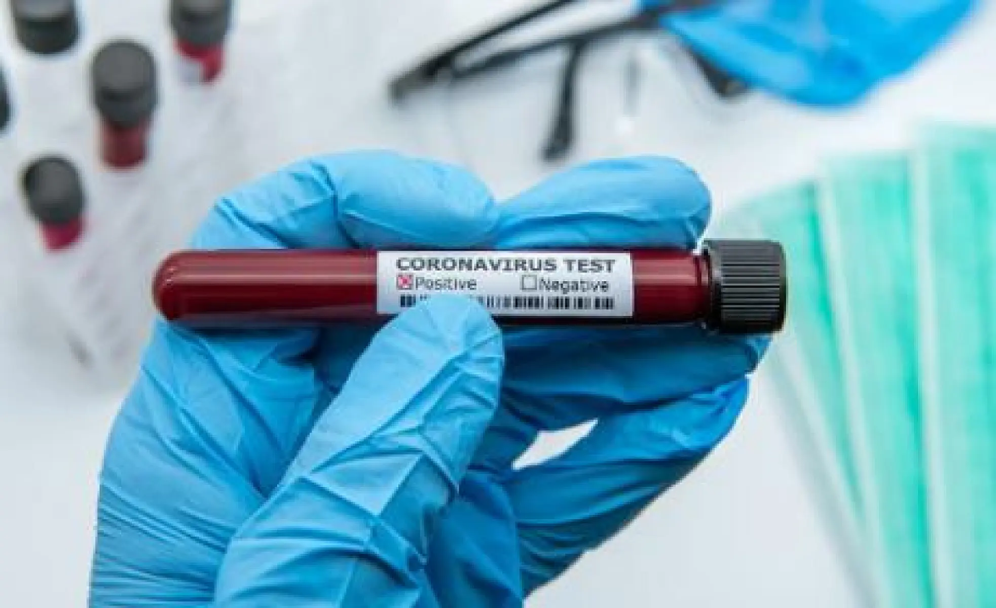 False Positive Covid Tests Will Extend Unjustified Lockdowns, Fauci Admits 'Miniscule' Accuracy
