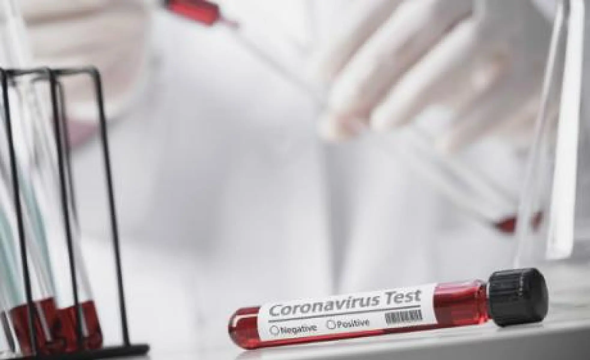 Covid-19 Data Review: Cases Do Not Warrant Public Hysteria or Lockdowns