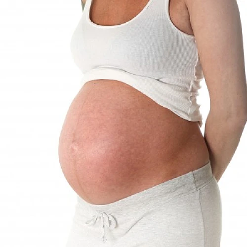 UnneCesareans: Documented Causes of a Disturbing Trend