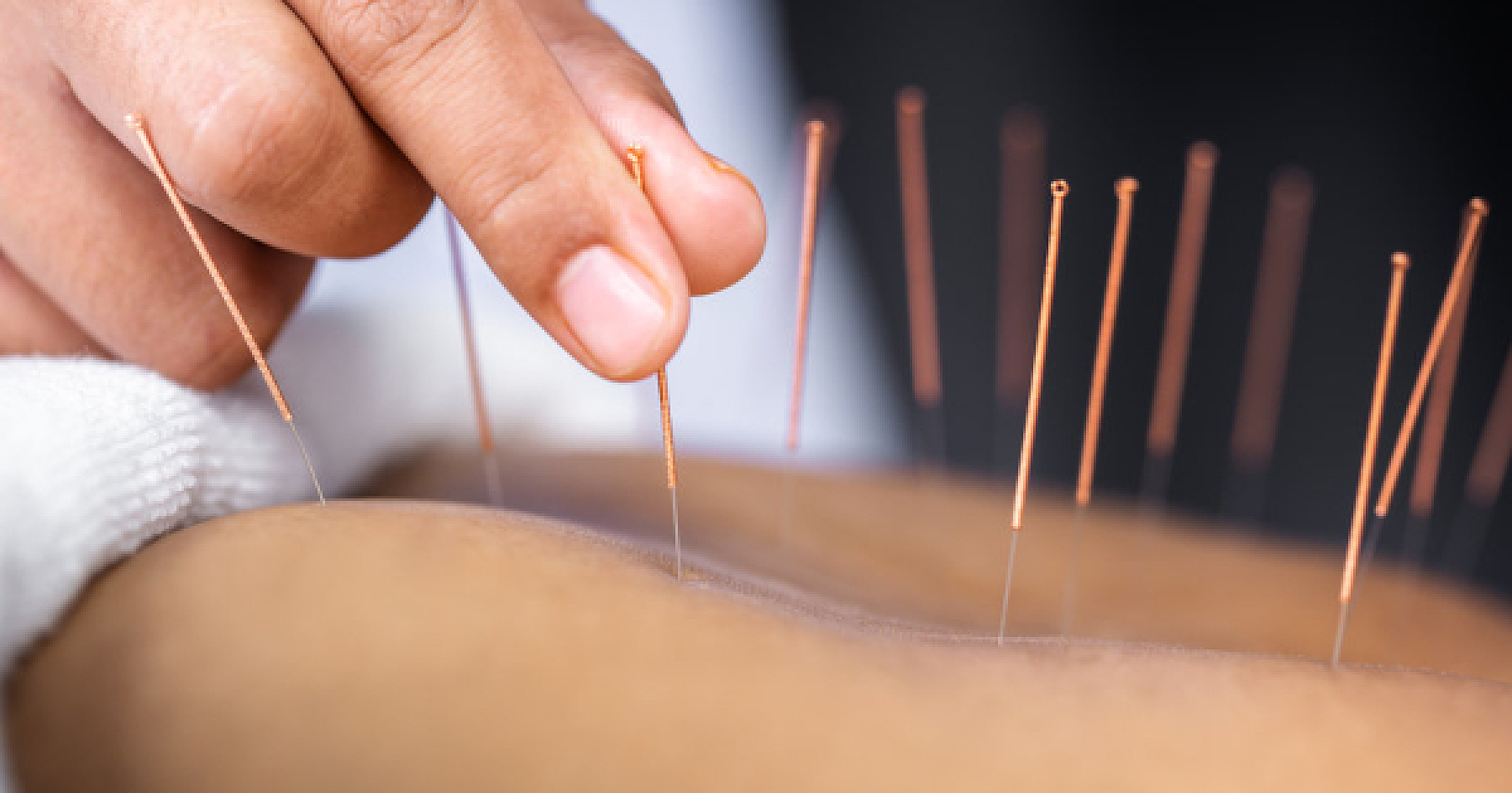Seven Top Reasons to Try Acupuncture
