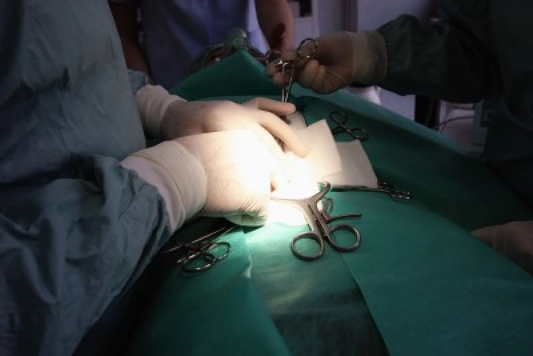 30 Years of Breast Screening: 1.3 Million Wrongly Treated