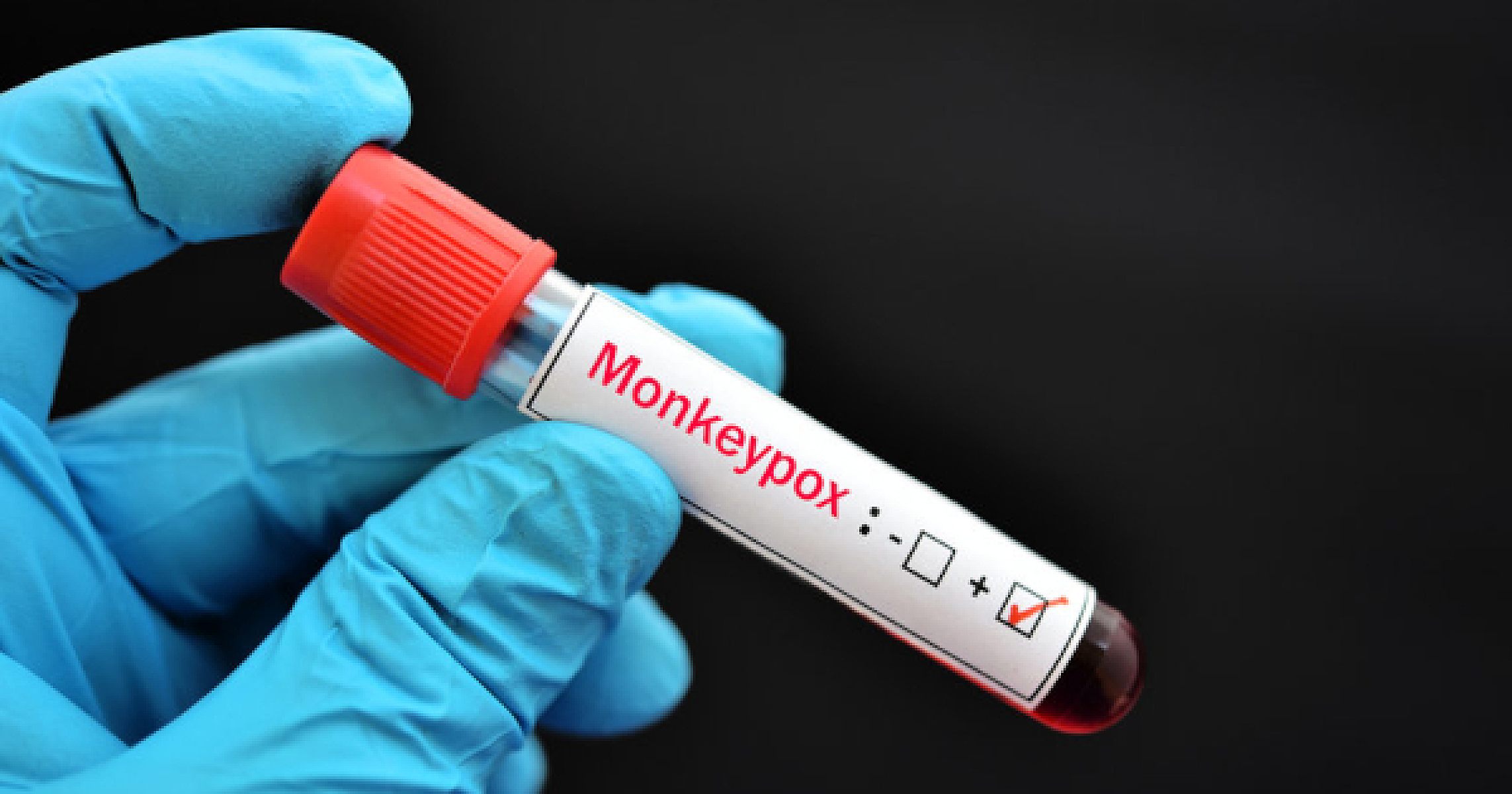 The Monkey Business Behind Monkeypox Propaganda