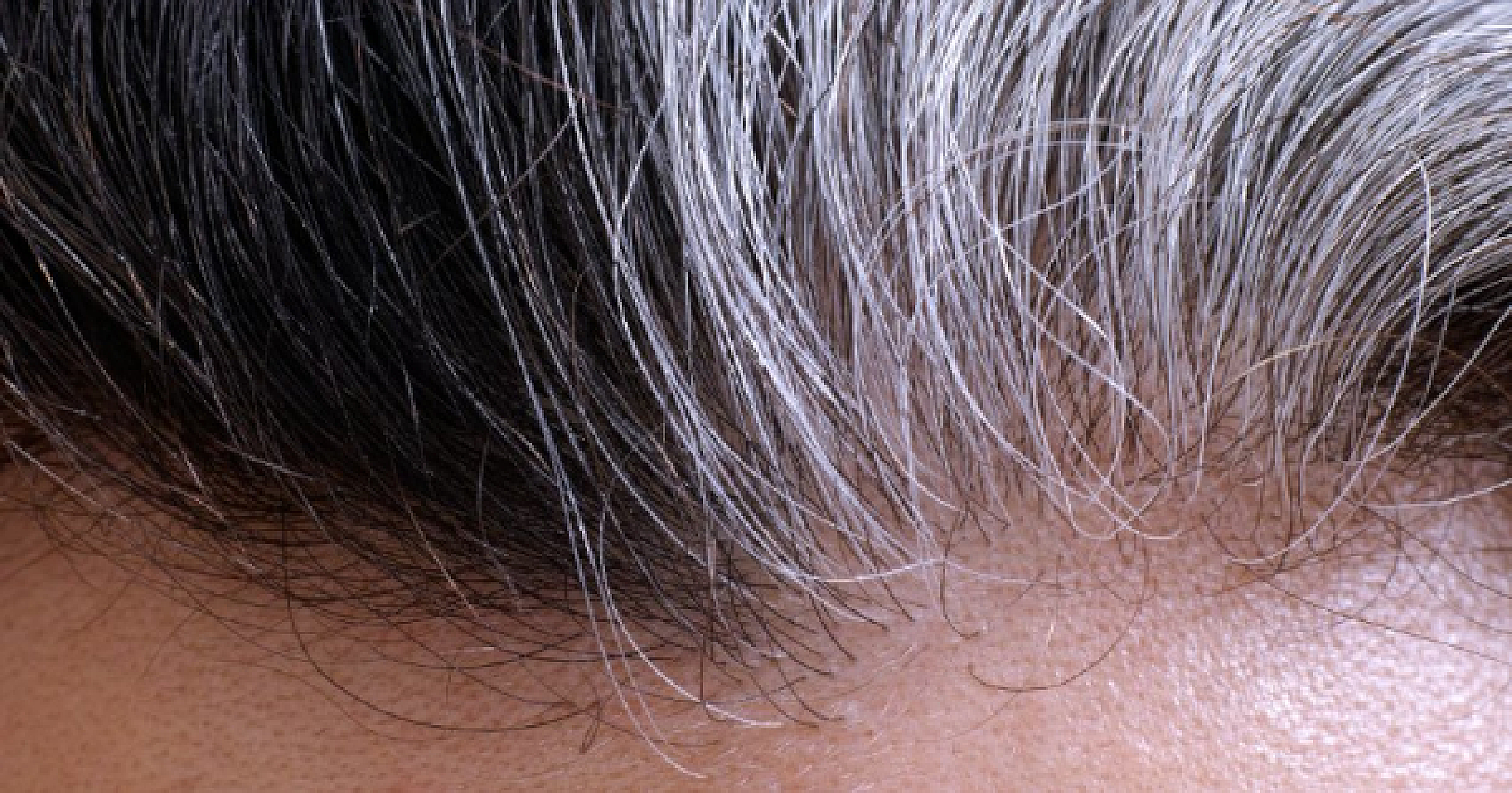 Grey Hair Can Regain Its Color - if You Relieve Stress