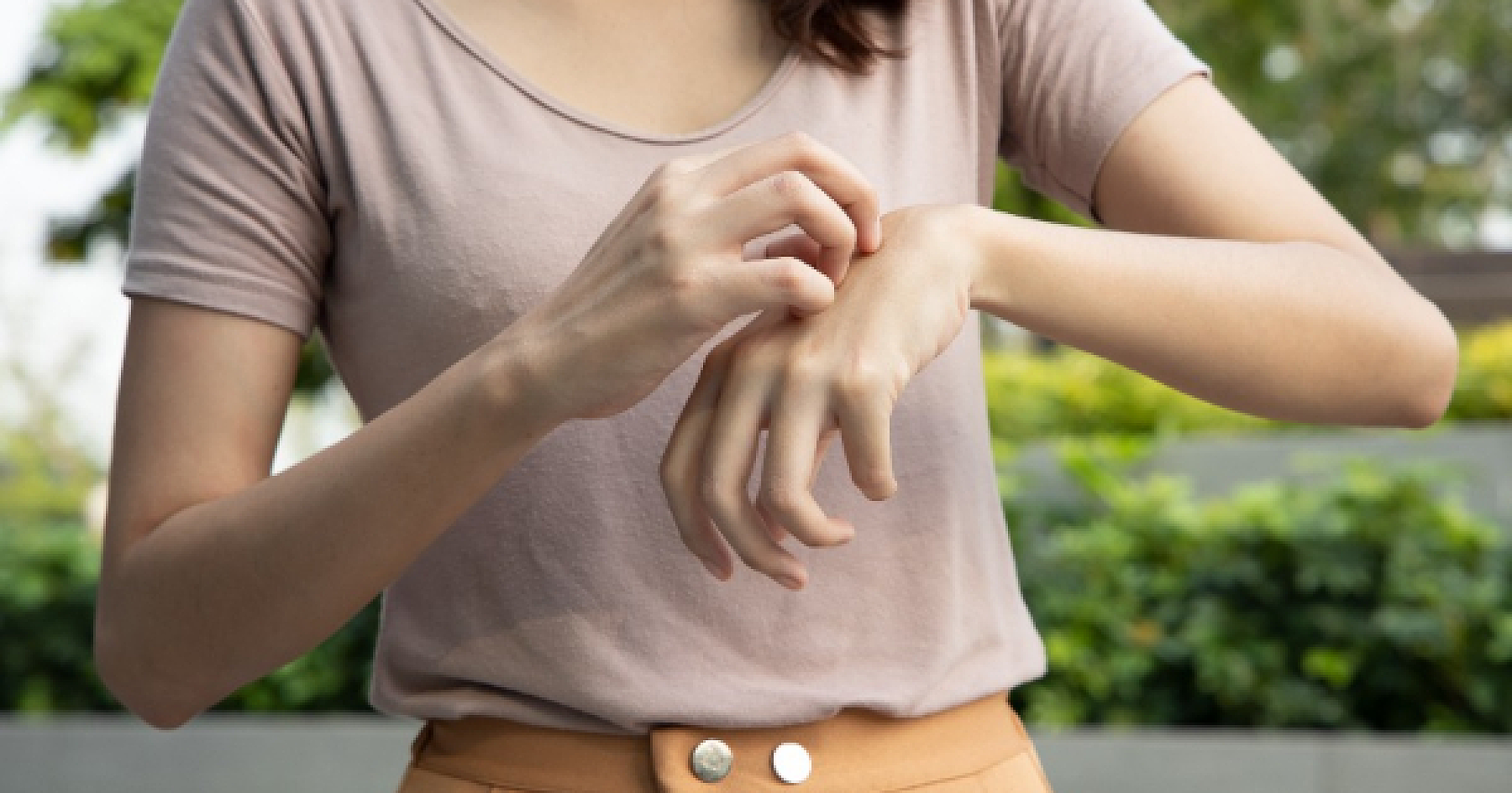 8 Natural Remedies for Eczema